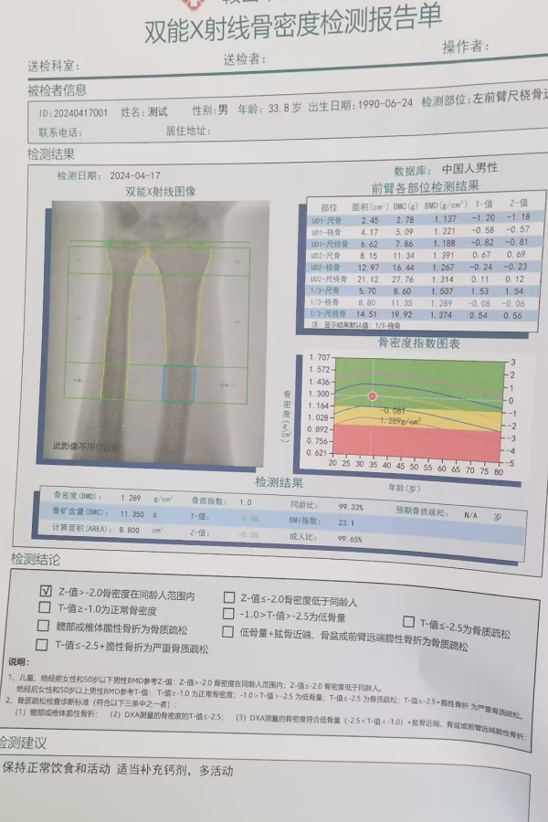 双能X射线骨密度仪：准确测量骨密度，助力骨质疏松防治，守护骨骼健康